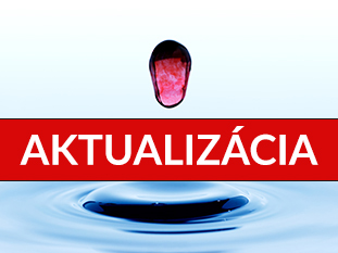 OZNAM VVS, a.s. k zásobovaniu pitnou vodou v meste Michalovce